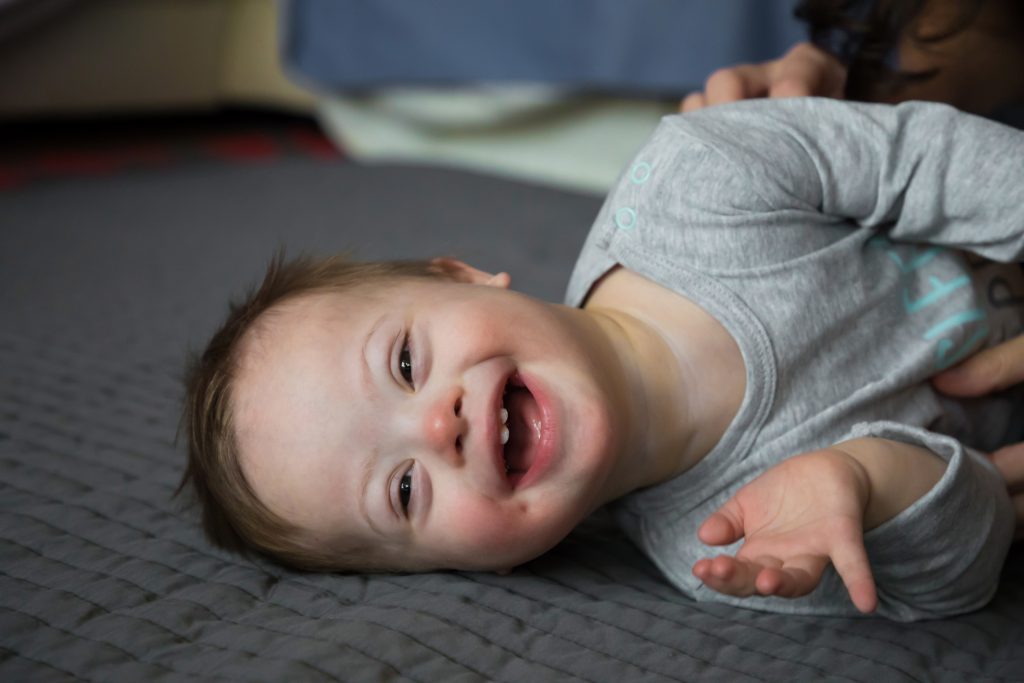 smiling baby with down syndrome lying on a bed - NY Supplemental Needs Trusts